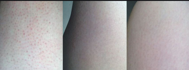 理肤泉身体乳含硅吗