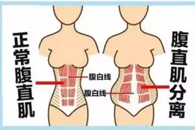 产后腹直肌修复这样练，快速打造完美身材图片