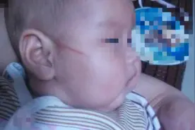 宝宝爱抓脸甚至把脸抓花，为何下手这么“狠”？原来暗示挺多问题图片