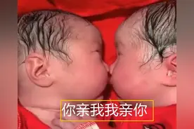 龙凤胎兄妹刚出生就“一直亲”，护士分都分不开，这画面太有趣图片
