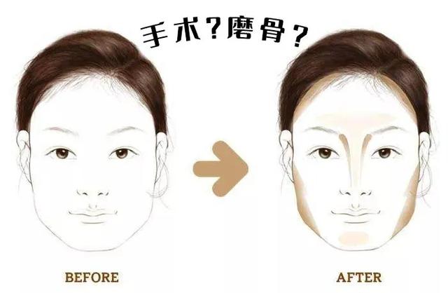 颧骨外凸与高低，两侧颧骨不对称，脸型又太凸，颧骨怎么运动改善