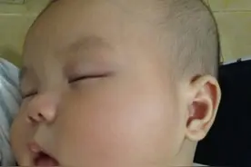 医生：想要孩子身体好，谨记晚上3不吃，睡前3不做，脾健康不湿疹图片