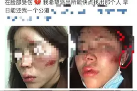 女子深夜被三名男子调戏，反抗后还遭殴打进医院！警方通报来了图片