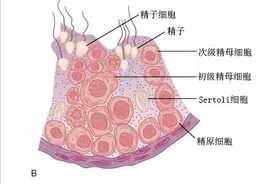 男性雄激素不足怎么办？图片