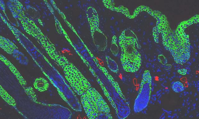 新型生物材料，轻松抚平疤痕