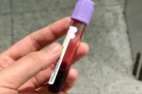 中国疾控中心：孕妇贫血率高达35%，食疗补铁“吃对”才不白补图片
