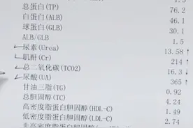 肾功能好不好，这四个指标很重要图片