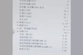 肾功能好不好，这四个指标很重要图片