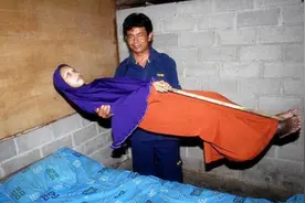 35岁女子活成“木头人”，十年身体未弯曲，家人仍不离不弃图片