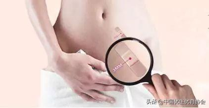宫腔镜手术后多久可怀孕（听刘大夫说宫腔镜手术后多久可以怀孕）