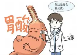 什么是胃食管反流病（GERD）？症状有哪些？听听专家怎么说？图片
