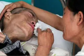 肿瘤医生坦言：要想癌症痊愈，就得熬过3道“生死坎”图片