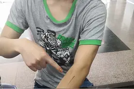 武林高手？男子以一敌三浴血击退抢匪？图片