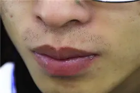 明明刚刮过胡子，很快又长了出来，胡子生长快慢和什么有关？图片