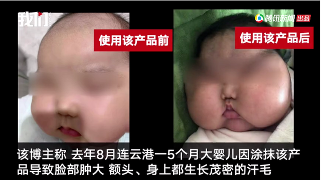 宝宝身体乳不含激素的
