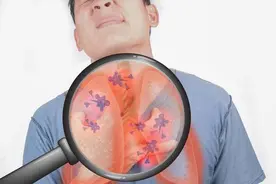 患上肺炎后，身体会有这5种表现，需引起重视，及时就医检查图片