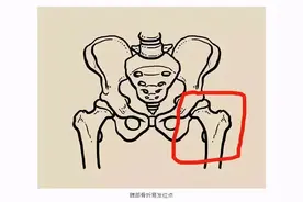 袁隆平院士跌倒到去世仅2个月！为什么它是老年人的"头号杀手"？图片