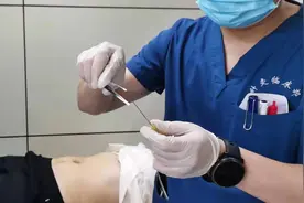 埋线减肥（穴位埋线）注意事项图片