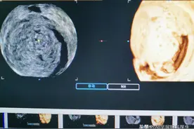 你知道为什么要定期孕检么？因为胎儿发育中会发生意想不到的问题图片