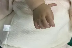 小儿疑难病症不用东奔西跑，渭南市妇幼（市儿童医院）一站式解决图片