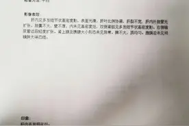 男子恶心呕吐在急诊科治疗无效，年轻大夫整夜思考发现病因图片