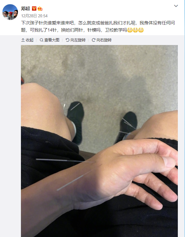 浑身疼起鸡皮疙瘩怎么了