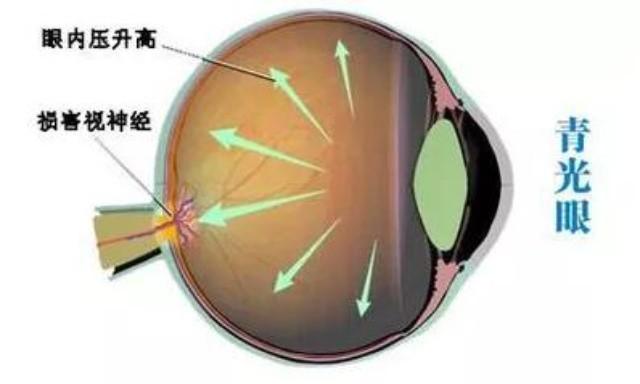 甲钴胺不仅能修复受损神经，还能用于这3种常见病的治疗，好用