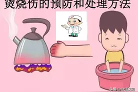 健康科普堂 | 日常生活预防小儿烧烫伤图片