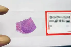 病理切片制作流程大公开！让你见识真正的“薄如蝉翼”图片