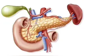 医师考试总结：急性胰腺炎（二）知识点分享！图片