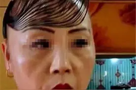 大妈花5万元植发，模仿明星做贴头皮造型，效果真让人哭笑不得图片