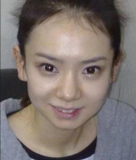 戚薇整容前照片高清,戚薇10年前旧照被疯传,素颜下的五官,确定不是