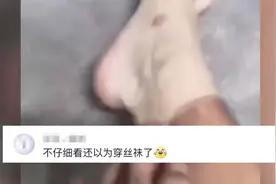 广东湛江一男子大热天排队打疫苗，回家一脱鞋傻眼了：自带黑丝袜图片