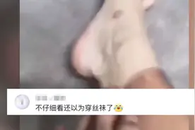 广东湛江一男子大热天排队打疫苗，回家一脱鞋傻眼了：自带黑丝袜图片