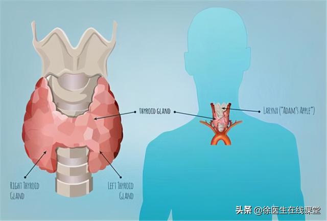 双侧甲状腺多发胶质结节 双侧甲状腺多发胶质结节2类