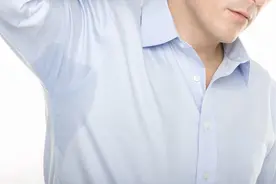 手术切除汗腺，可根治狐臭图片