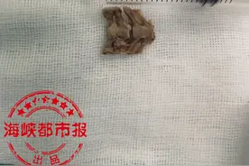 米饭配鸽子汤，福州一男孩被骨头卡喉图片