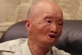 志愿军涂伯毅被汽油弹毁容，上街吓哭孩子后，一度不敢再出门图片