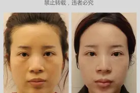 从“微整”到“动刀”，喜欢自然风的她为啥忽然“大动干戈”图片