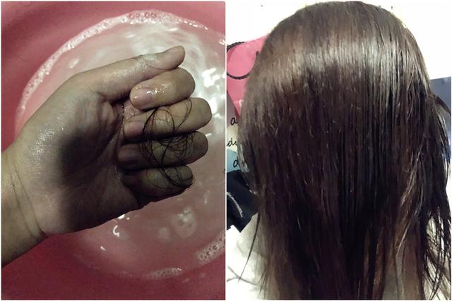 鐢勬矏榫欒鏍戞礂鎶ゅ彂濂楄鈥斺€斿府浣犺繙绂绘帀鍙戦棶棰? onerror=