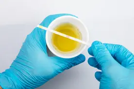 大量出现蛋白尿时，可以补充蛋白吗？教你6招，坚持就能护肾图片