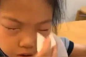 浙江9岁女孩看见数学题，眼睛周围就过敏，让人惊讶不解图片