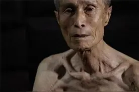 长崎原子弹爆炸后的幸存者，哭诉：人类为何要制造这种“怪物”图片