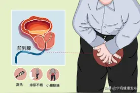 19岁就“前列腺炎”65岁还需要“丁丁历险”图片