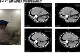 南昌大学第二附属医院肿瘤科五大亚专业之胃/直肠肿瘤/淋巴瘤/软组织肿瘤亚专业图片