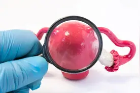 卵巢功能下降的原因是什么？保护卵巢教你 5 招图片