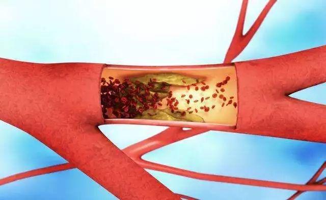 鲟软骨胶原蛋白肽的功效 鲟软骨胶原蛋白肽的功效与禁忌