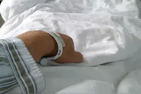 说说我刚经历的肛瘘手术图片