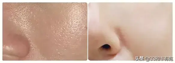 火爆INS的芝士皂，洗脸就像敷面膜，痘痘，黑头，螨虫全都消失了