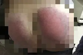 “她不躲不哭，我以为板子不痛！”女童因未完成作业被老师殴打住院，老师的解释令人气愤图片